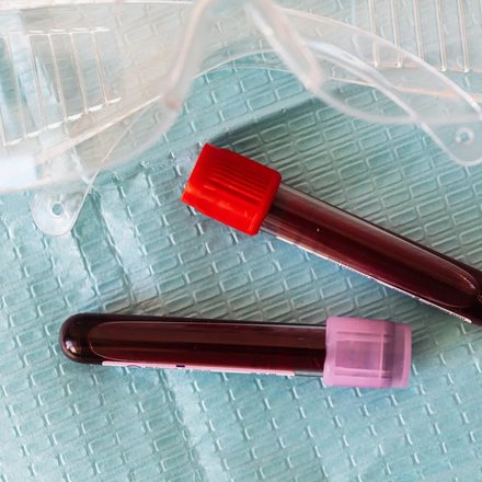 Blood sample tubes resting on a clinic tray